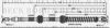BORG & BECK BBH7915 Brake Hose